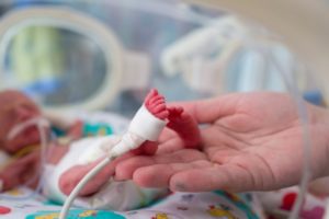 Anticipating Neonatal Resuscitation